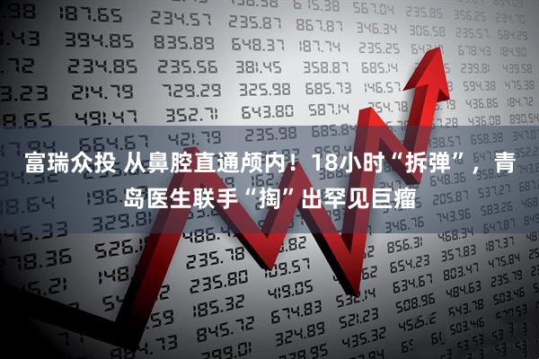 富瑞众投 从鼻腔直通颅内！18小时“拆弹”，青岛医生联手“掏”出罕见巨瘤